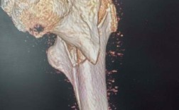 浙大骨科考博真题难度如何？