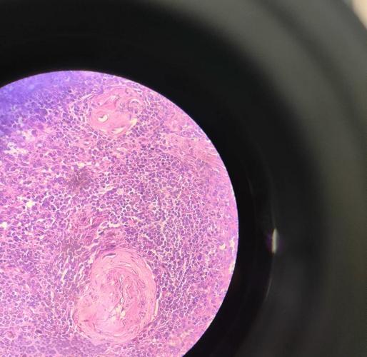 昆明医科大学考博病理学难度如何?-图3 昆明医科大学考博病理学难度如何?-图3