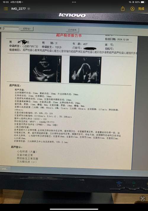 山东大学考博心内科真题难度如何？-图2