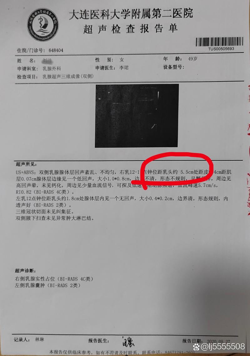 三军医大考博病理真题难度如何?-图2 三军医大考博病理真题难度如何?-图2