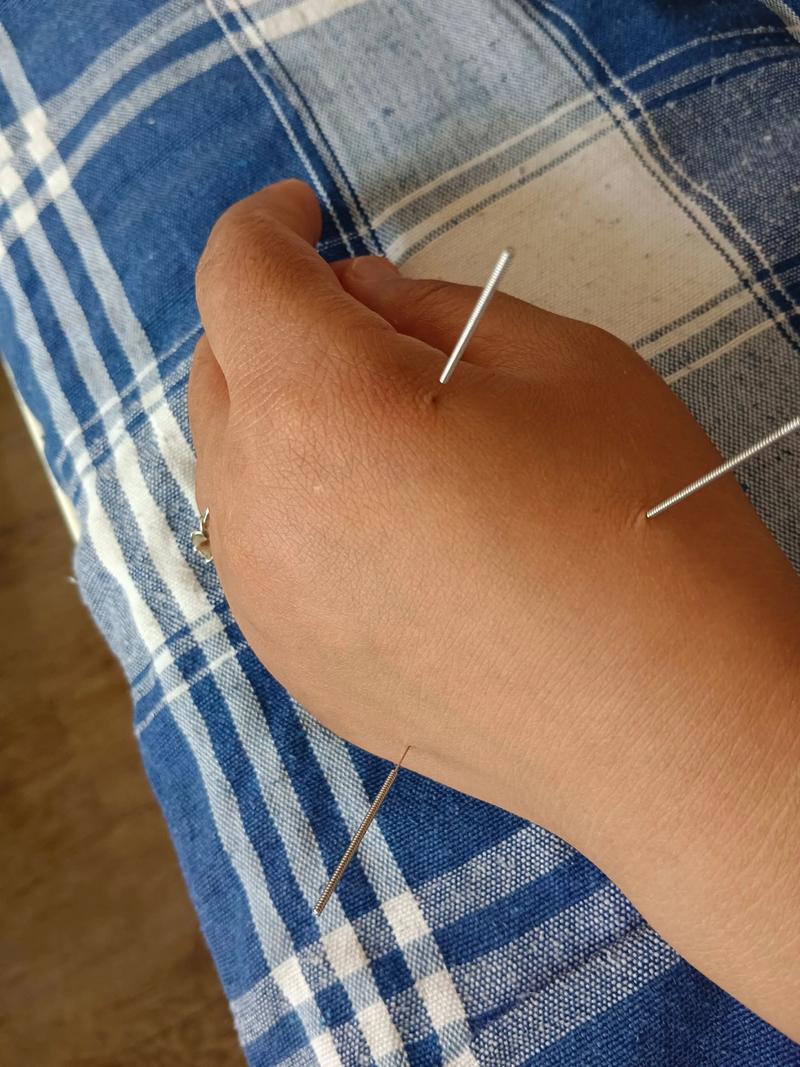 辽宁中医药大学考博针灸难不难？-图3