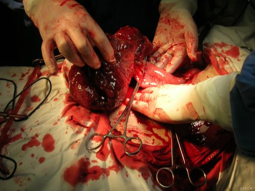 肿瘤生物学考博，如何高效备考？-图3