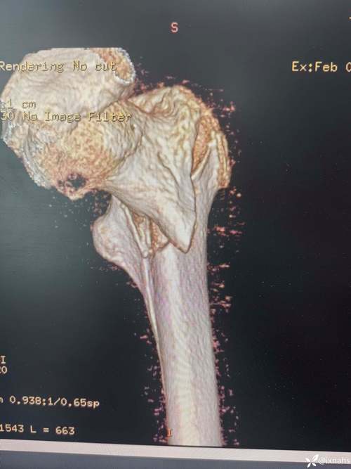 浙大骨科考博真题难度如何？-图1