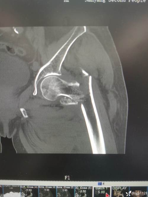 浙大骨科考博真题难度如何？-图2