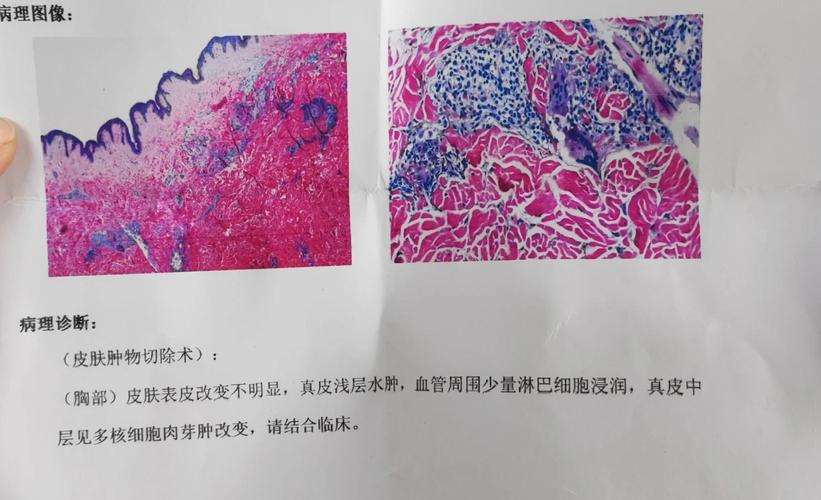 广西医科大学考博病理考什么？-图2