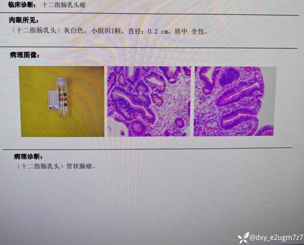 山西医科大学考博病理-图1