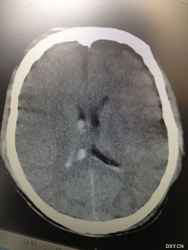 中科院神经生物学考博难度如何？-图3