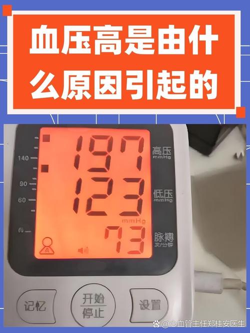 考博体检血压高会影响录取吗？-图1