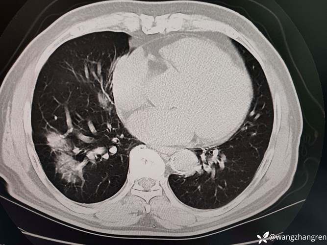 中山大学影像考博真题考什么？-图2